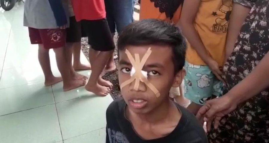 Hujan Angin Terjadi Di Bukateja, Puluhan Rumah Rusak Dan Satu Warga Al