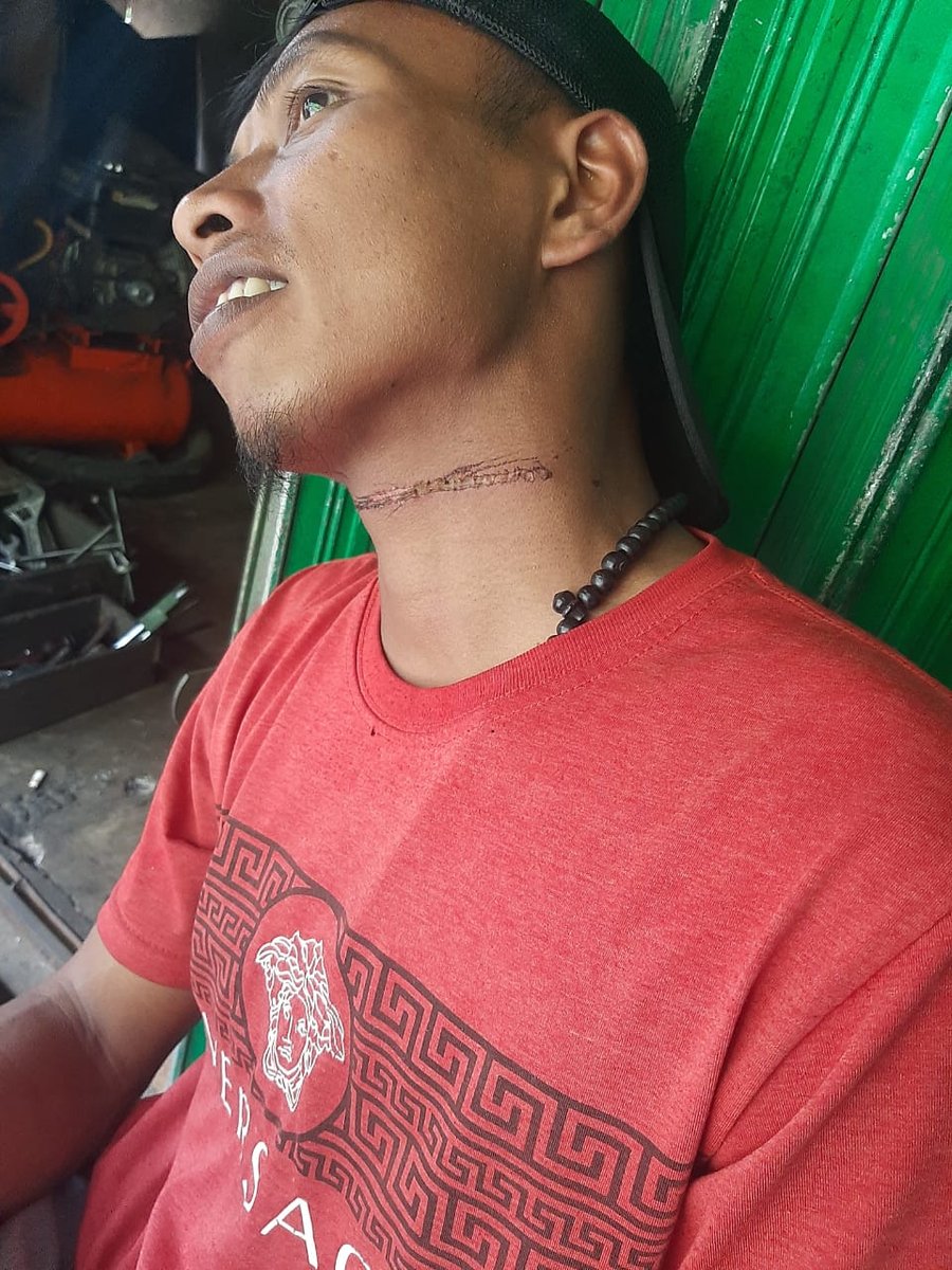 Kabel Jalur Wifi Telan Korban Kecelakaan Pengendara Motor