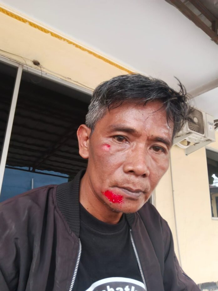 Pimpinan Redaksi Media Online Aktual Banten Diduga Dianiaya Oknum Debt